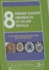 Image of 8 Prinsip Dasar Membaca CT-Scan Kepala