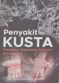 Penyakit Kusta : pencegahan, penanganan, perawatan , pengobatan